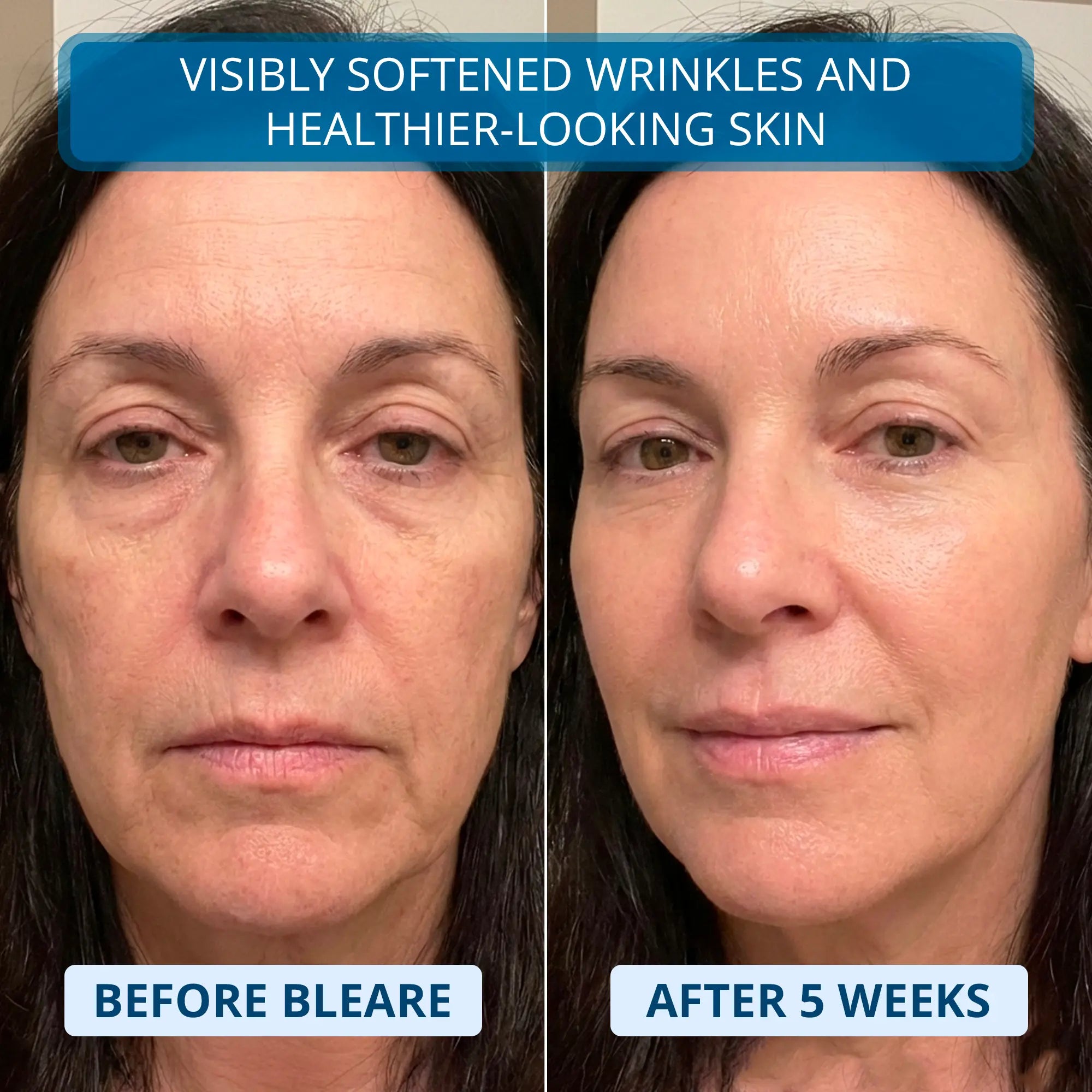 3% Ultra Hydrating Hyaluronic Acid Serum by Bleare™